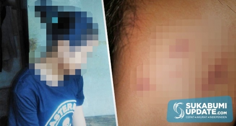 Banyak Tanda Merah di Leher Anaknya, Orang Tua Murid Polisikan Oknum Guru SMA di Cibadak Kabupaten S